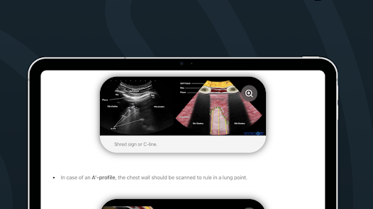 Point of Care Ultrasound Mod APK 1.0.3 (Unlocked) Gallery 9