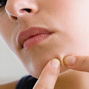 Acne Pimple Treatment