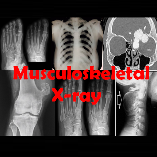 Musculoskeletal X-ray App