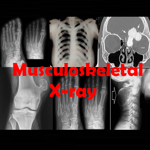 Musculoskeletal X-ray App logo