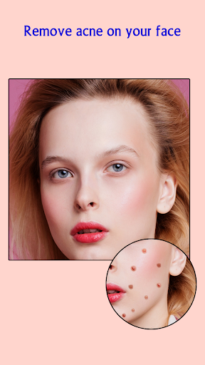 Remove Acne from Face Screen 3