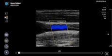 SONON X Ultrasound Appのおすすめ画像1