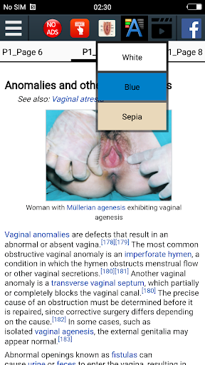 Vagina Anatomy