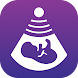دليل المرأة الحامل - دليل حملي - Androidアプリ