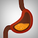 Healthy Digestion Foods Diet - Androidアプリ