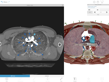 Human Anatomy Atlas 2021:u00a0Complete 3D Human Body 2021.2.27 Screenshots 13