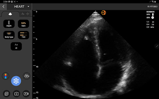 Kosmos Ultrasound Screen 2