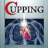Cupping icon
