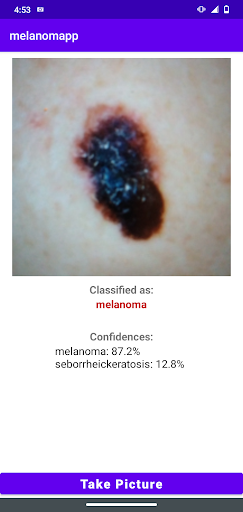 Android application MelanomApp screenshort