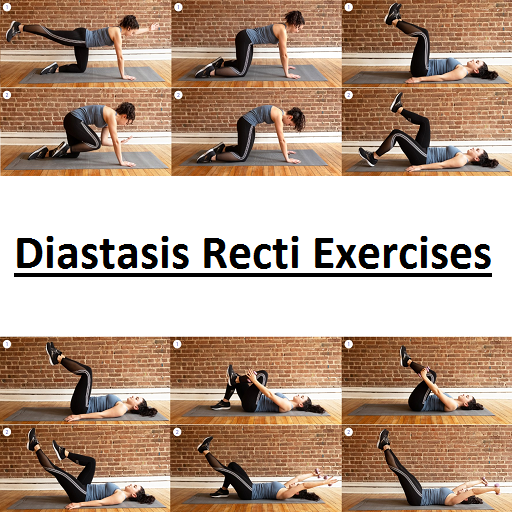 Diastasis Recti Exercises - Apps on Google Play