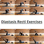 Cover Image of Download Diastasis Recti Exercises  APK