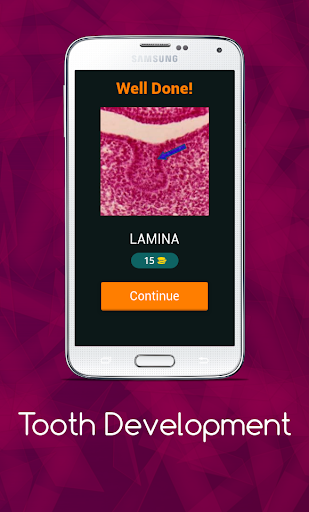 Tooth Development Quiz Screen 3