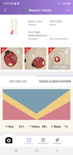 eKare inSight Research Screen 2
