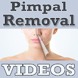 Pimple Removal Tips VIDEOs icon
