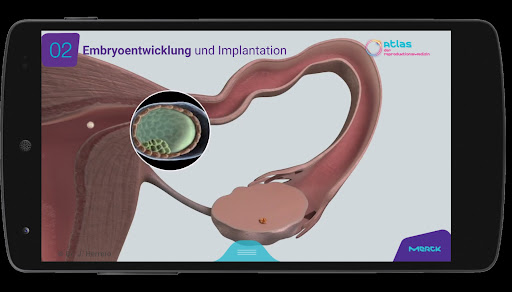Fertility Atlas - Merck Screen 2