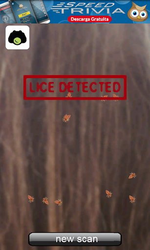 Lice Detector (prank) Screen 3