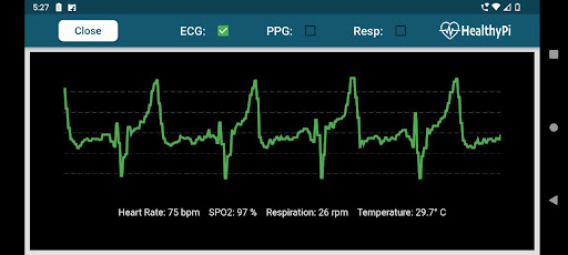 HealthyPi Screen 2