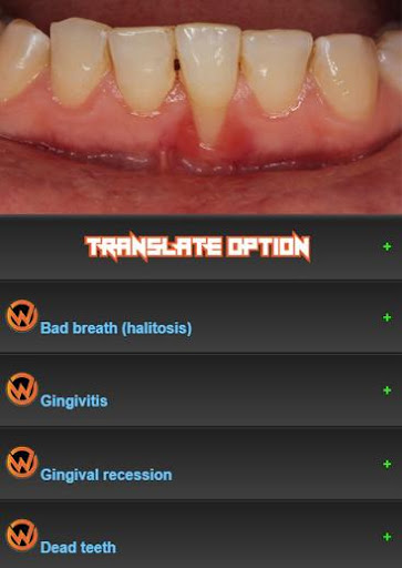 Android application All dental diseases screenshort