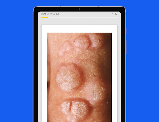 AGNP Mastery ANCC AANP Prep screenshot 16