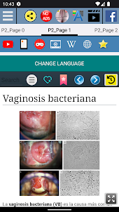 Vaginosis bacteriana Terapia