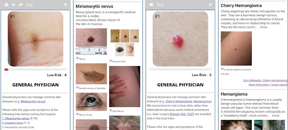 Model Dermatol  -  Skin Disease