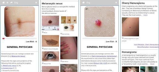 Model Dermatology–Skin Disease screenshots 2