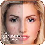 Cover Image of Download Face Blemishes Removal  APK