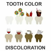 Tooth Discoloration (Stain)