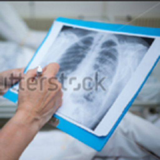 Chest X-Ray Based Cases Auf Windows herunterladen
