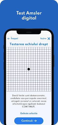 Macula Screen 3
