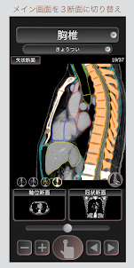 CT Passport 胸部 / CT断面図解剖アプリ / MRI