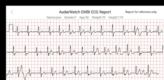 Montre connectée ecg electrocardiogramme homme femme – audar e1 – cardio,  tension, waterproof, gps - android et apple AUDAR Pas Cher 