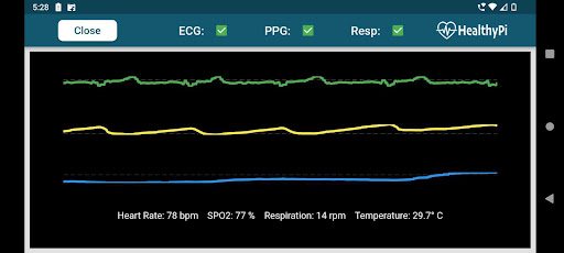 Android application HealthyPi screenshort