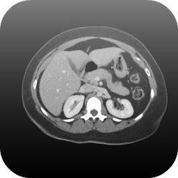 Icon image Radiology CT Viewer
