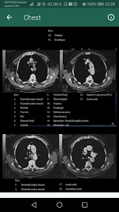 CT Scan Anatomy