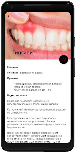 Заболевания полости рта Screen 3