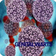 Genitalwarts Infection
