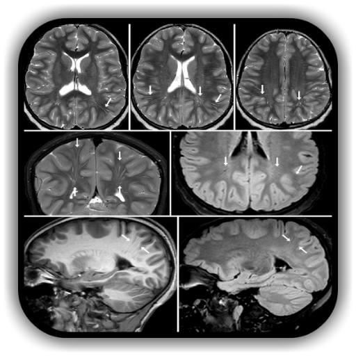 Imaging Brain Skull Craniocervical Vasculature Google Play のアプリ