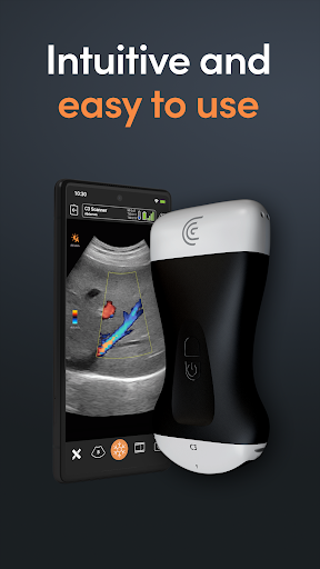 Clarius Ultrasound App screenshot for Android