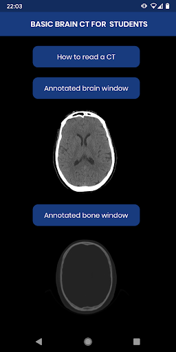 Android application Brain CT : annotated slices screenshort