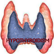 Hypothyroidism Disease