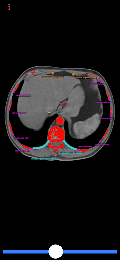 Biopsy Guide Screen 2