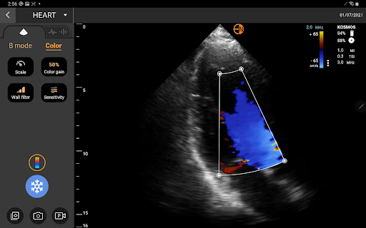 Kosmos Ultrasound Screen 3