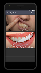 Teeth whitening at home 2.0.0 APK + Mod (Unlimited money) untuk android