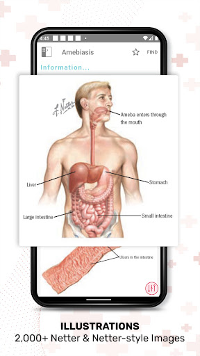 Ferris Netter Patient Advisor Screen 3