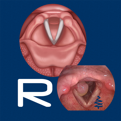 Reflux logo