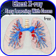 Top 38 Medical Apps Like Chest X-ray Easy Learning - Best Alternatives