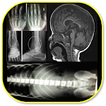 Cover Image of Baixar Musculoskeletal X-Rays - All in 1 1.1.9 APK