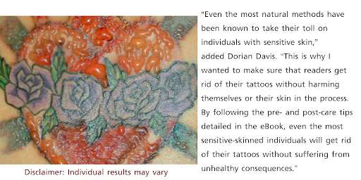 Natural Tattoo Removal Screen 3