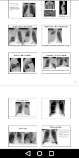 Medical X-Ray Interpretation with 100+ Cases  Screenshots 15